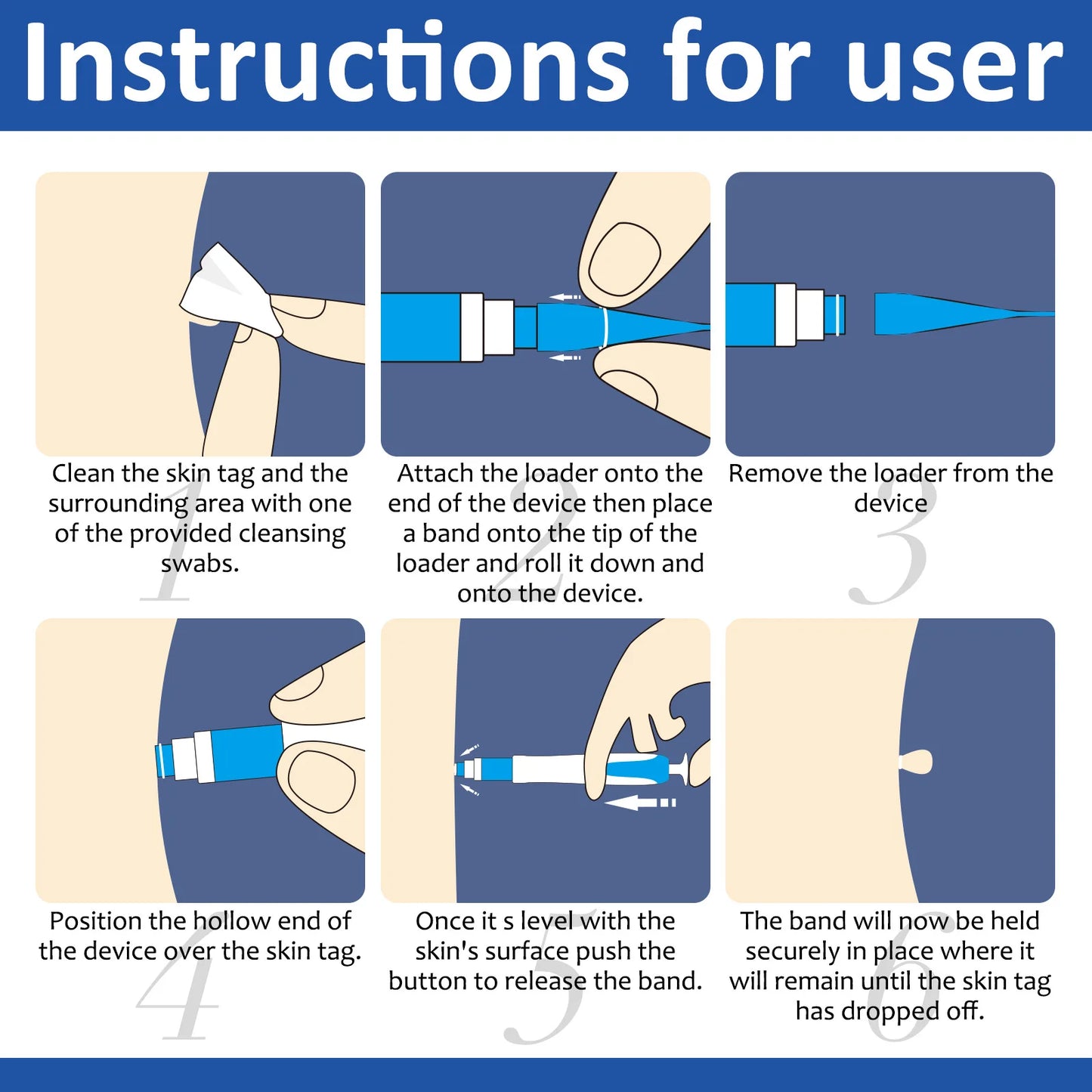 Tagbuddy™ kit (No more skin tags )